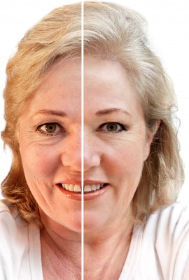 Anti Aging Treatment 